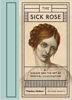 SICK ROSE: DISEASE IN THE GOLDEN AGE OF MEDICAL: DISEASE AND THE ART OF MEDICAL ILLUSTRATION | 9780500517345 | BARNETT, RICHARD